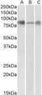 Delta Like Canonical Notch Ligand 4 antibody, TA326315, Origene, Western Blot image 