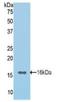 Cadherin 1 antibody, LS-C299423, Lifespan Biosciences, Western Blot image 