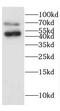 Cerebral Endothelial Cell Adhesion Molecule antibody, FNab01612, FineTest, Western Blot image 