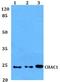 ChaC Glutathione Specific Gamma-Glutamylcyclotransferase 1 antibody, A09017, Boster Biological Technology, Western Blot image 