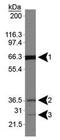 Folliculin antibody, PA5-23016, Invitrogen Antibodies, Western Blot image 