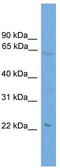 EH Domain Containing 1 antibody, TA340138, Origene, Western Blot image 