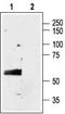 Gamma-Aminobutyric Acid Type A Receptor Alpha3 Subunit antibody, TA328699, Origene, Western Blot image 