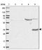 ST8 Alpha-N-Acetyl-Neuraminide Alpha-2,8-Sialyltransferase 4 antibody, NBP2-13393, Novus Biologicals, Western Blot image 