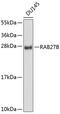RAB27B, Member RAS Oncogene Family antibody, 23-755, ProSci, Western Blot image 