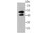 Interleukin 13 Receptor Subunit Alpha 1 antibody, NBP2-75538, Novus Biologicals, Western Blot image 