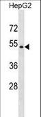 Nuclear Receptor Subfamily 1 Group H Member 4 antibody, LS-C158421, Lifespan Biosciences, Western Blot image 