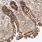 RNA methyltransferase-like protein 1 antibody, HPA023292, Atlas Antibodies, Immunohistochemistry paraffin image 