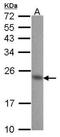 Calcium And Integrin Binding 1 antibody, NBP1-31298, Novus Biologicals, Western Blot image 