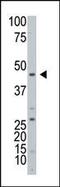 ADP-Ribosyltransferase 3 antibody, 61-368, ProSci, Western Blot image 