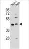 Zinc Finger Protein 384 antibody, PA5-71602, Invitrogen Antibodies, Western Blot image 