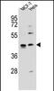 Zinc Finger Protein 384 antibody, PA5-71602, Invitrogen Antibodies, Western Blot image 