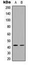 Fos-related antigen 1 antibody, abx121479, Abbexa, Western Blot image 