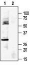 Potassium Voltage-Gated Channel Subfamily J Member 8 antibody, TA328967, Origene, Western Blot image 