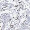Surfactant Protein C antibody, NBP1-87201, Novus Biologicals, Immunohistochemistry frozen image 