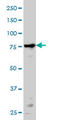 Protein Kinase C Alpha antibody, LS-C133397, Lifespan Biosciences, Western Blot image 