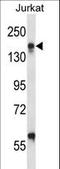 Integrin Subunit Alpha L antibody, LS-B10681, Lifespan Biosciences, Western Blot image 