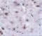 Regulator Of Calcineurin 2 antibody, 5051, ProSci, Immunohistochemistry paraffin image 