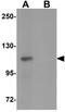 VPS39 Subunit Of HOPS Complex antibody, GTX32005, GeneTex, Western Blot image 