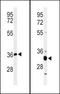 ST8 Alpha-N-Acetyl-Neuraminide Alpha-2,8-Sialyltransferase 4 antibody, TA325113, Origene, Western Blot image 