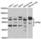 Heparanase antibody, LS-C334247, Lifespan Biosciences, Western Blot image 