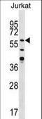 Calcium/Calmodulin Dependent Protein Kinase II Gamma antibody, LS-C100734, Lifespan Biosciences, Western Blot image 