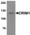 Cysteine Rich Transmembrane BMP Regulator 1 antibody, orb75822, Biorbyt, Western Blot image 