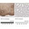 Keratin 15 antibody, NBP1-85603, Novus Biologicals, Immunohistochemistry paraffin image 