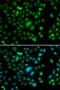 Kv channel-interacting protein 2 antibody, orb247804, Biorbyt, Immunocytochemistry image 