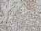 RB Binding Protein 4, Chromatin Remodeling Factor antibody, PA5-30422, Invitrogen Antibodies, Immunohistochemistry paraffin image 