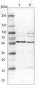 Sorting nexin-4 antibody, NBP1-88882, Novus Biologicals, Western Blot image 