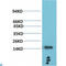 Transthyretin antibody, LS-C813247, Lifespan Biosciences, Western Blot image 