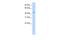 TRNA Nucleotidyl Transferase 1 antibody, A06030, Boster Biological Technology, Western Blot image 