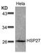 Heat Shock Protein Family B (Small) Member 1 antibody, 79-378, ProSci, Western Blot image 