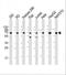 Insulin Like Growth Factor 2 MRNA Binding Protein 1 antibody, A02007-1, Boster Biological Technology, Western Blot image 