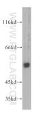 Plasminogen Activator, Urokinase antibody, 17968-1-AP, Proteintech Group, Western Blot image 