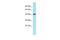 Killer cell immunoglobulin-like receptor 2DL5B antibody, PA5-70711, Invitrogen Antibodies, Western Blot image 