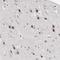 Tripartite Motif Containing 33 antibody, HPA004345, Atlas Antibodies, Immunohistochemistry paraffin image 