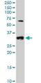 Cyclin D2 antibody, H00000894-B01P, Novus Biologicals, Western Blot image 