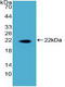 Dyskerin Pseudouridine Synthase 1 antibody, LS-C725555, Lifespan Biosciences, Western Blot image 
