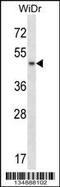 Ankyrin Repeat And Sterile Alpha Motif Domain Containing 4B antibody, 57-938, ProSci, Western Blot image 