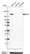 BRCA1 Interacting Protein C-Terminal Helicase 1 antibody, NBP2-14361, Novus Biologicals, Western Blot image 