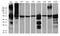 Chaperonin Containing TCP1 Subunit 4 antibody, LS-C795648, Lifespan Biosciences, Western Blot image 