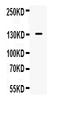 Nitric oxide synthase antibody, A00368, Boster Biological Technology, Western Blot image 