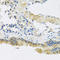 CAP-Gly Domain Containing Linker Protein 1 antibody, A08907-1, Boster Biological Technology, Immunohistochemistry paraffin image 