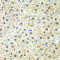 Proteasome 26S Subunit, Non-ATPase 13 antibody, LS-C346154, Lifespan Biosciences, Immunohistochemistry paraffin image 