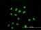 Chromodomain Y-like protein antibody, H00009425-M02, Novus Biologicals, Immunofluorescence image 