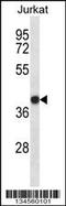 SET Nuclear Proto-Oncogene antibody, 57-833, ProSci, Western Blot image 