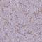 PSMB8 antibody, HPA050327, Atlas Antibodies, Immunohistochemistry paraffin image 