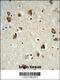 Ribosomal Protein S6 Kinase B2 antibody, 63-338, ProSci, Immunohistochemistry paraffin image 
